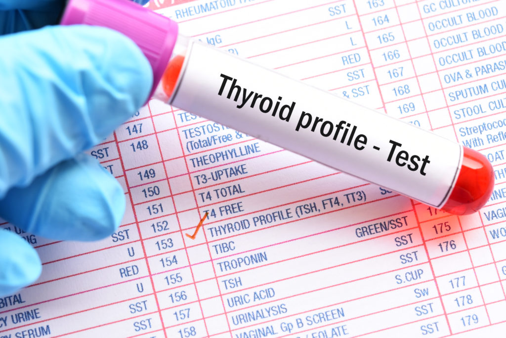 Thyroid bloodwork for thyroid profile test