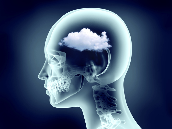 x-ray image of human head with cloud