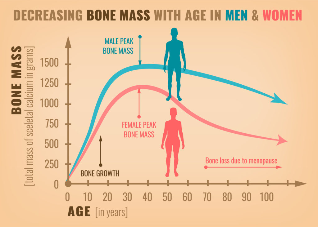 Osteoporosis Decreasing bone mass with age in men and women. Detailed infographic in beige, pink and blue colors. Vector illustration. Healthcare and medicine concept.